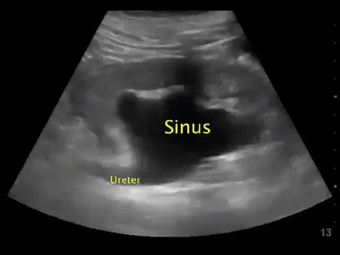 Ultrasound annotated