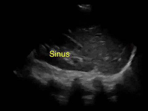 Ultrasound annotated