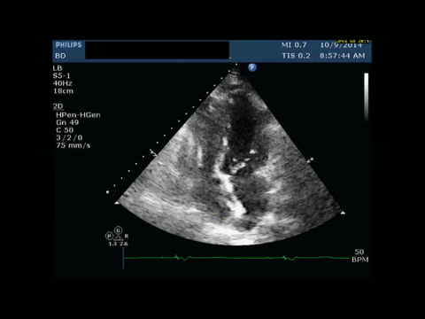 Ultrasound
