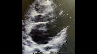 POCUS