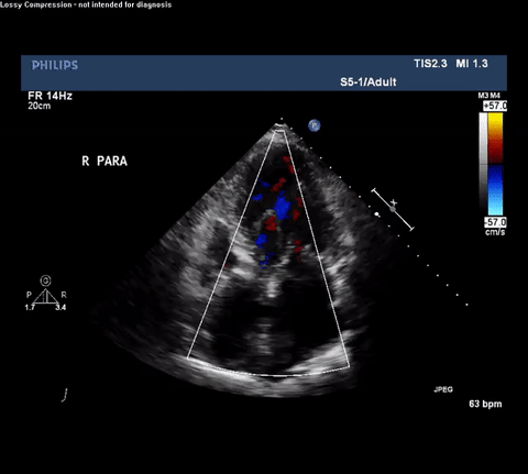 CT Thorax with angiogram