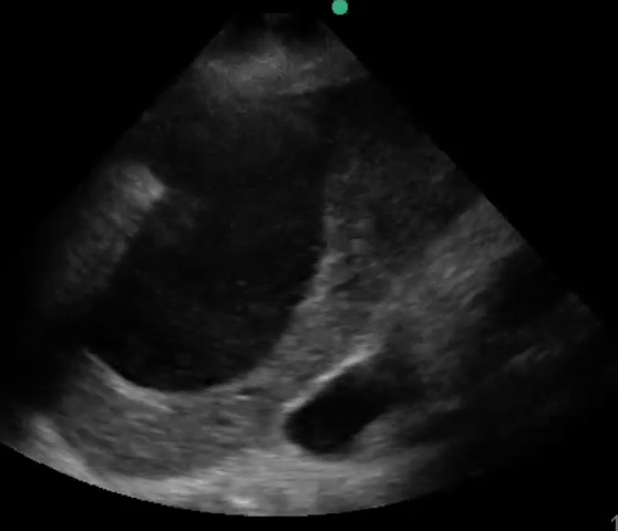 Point-of-care sonography