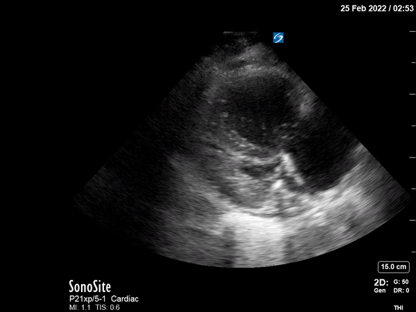 Parasternal long axis