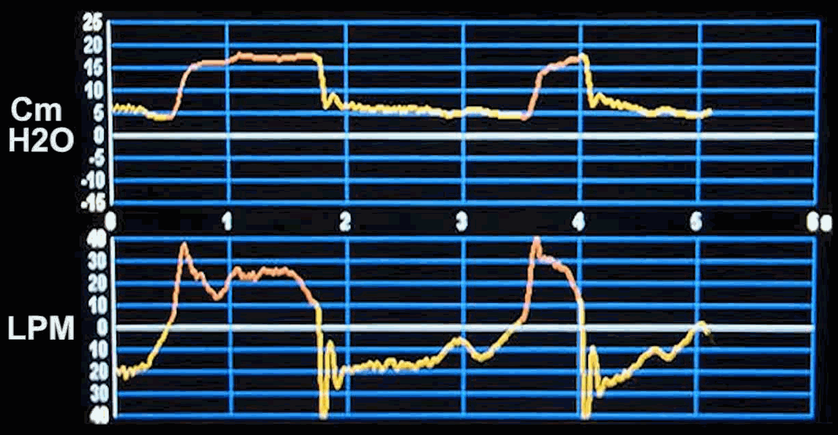 Video Clip of Waveform